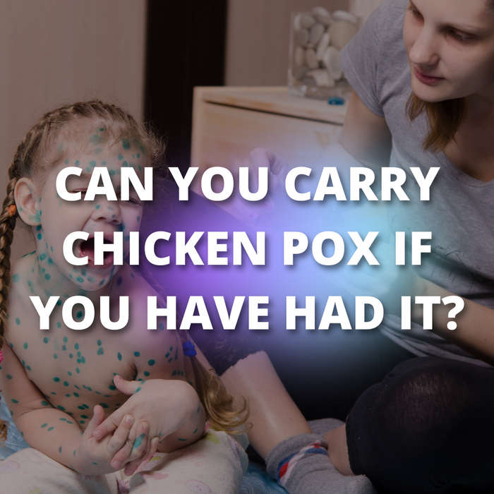 Can You Carry Chicken Pox If You Have Had It?