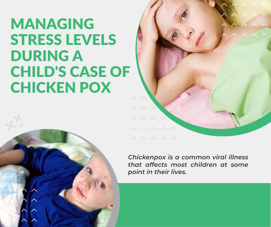 Managing Stress Levels During a Child's Case of Chicken Pox