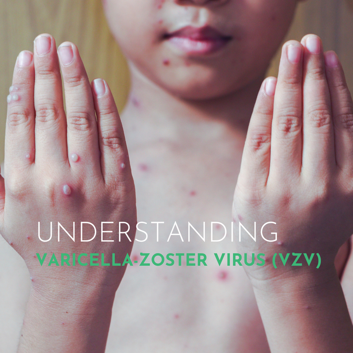 Understanding the Varicella-Zoster Virus (VZV)