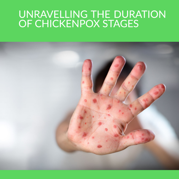 child with chickenpox reaching hand out - Unravelling the Duration of Chickenpox Stages